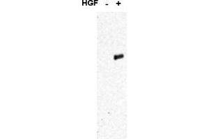 Image no. 1 for anti-Met Proto-Oncogene (MET) (pTyr1349), (pTyr1356) antibody (ABIN401382) (c-MET antibody  (pTyr1349, pTyr1356))