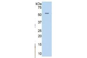 Western Blotting (WB) image for Alanine Aminotransferase (ALT) ELISA Kit (ABIN6730944)