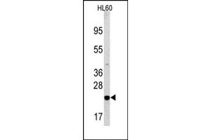 Image no. 2 for anti-BCL2-Associated Agonist of Cell Death (BAD) (Middle Region) antibody (ABIN356826) (BAD antibody  (Middle Region))