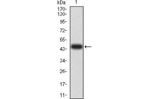 Western blot analysis using NAA10 mAb against human NAA10 (AA: 111-235) recombinant protein. (NAA10 antibody  (AA 111-235))