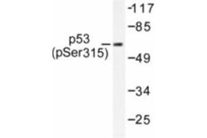 Image no. 1 for anti-Tumor Protein P53 (TP53) (pSer315) antibody (ABIN318092) (p53 antibody  (pSer315))