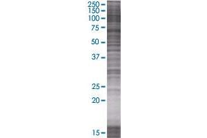 Western Blotting (WB) image for HMGCR 293T Cell Transient Overexpression Lysate(Denatured) (ABIN1332160)