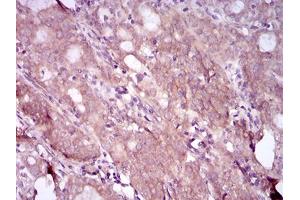 Immunohistochemistry (IHC) image for anti-EGFR Mutant (AA 693-893) antibody (ABIN1724824)