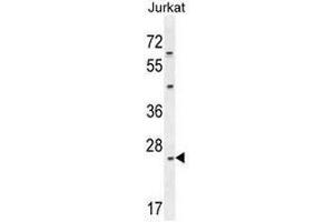 CLDN22 Antibody (Center) western blot analysis in Jurkat cell line lysates (35µg/lane). (Claudin 22 (CLDN22) (AA 97-126), (Middle Region) antibody)
