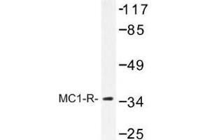 Image no. 1 for anti-Melanocortin 1 Receptor (MC1R) antibody (ABIN317707) (MC1 Receptor antibody)