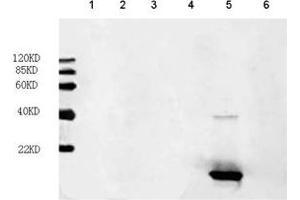 Primary antibody: 1 µg/mL FGF acidic Antibody, mAb, mouse (ABIN399028) Secondary antibody: IRDye800 Conjugated affinity purified anti-Mouse IgG [GOAT] (1: 10,000) Loading: Lane 1: hFGF-6 recombinant protein (200 ng) Lane 2: hFGF-16 recombinant protein (200 ng) Lane 3: hFGF-17 recombinant protein (200 ng) Lane 4: hFGF-18 recombinant protein (200 ng) Lane 5: FGF acidic recombinant protein (200 ng) Lane 6: FGF basic recombinant protein (200 ng) (FGF acidic antibody)