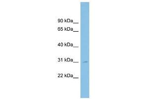 SLC39A9 antibody used at 1 ug/ml to detect target protein. (SLC39A9 antibody)