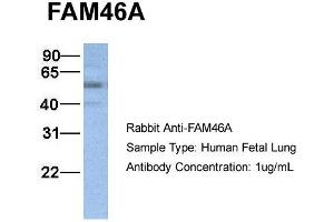 Host:  Rabbit  Target Name:  FAM46A  Sample Type:  Human Fetal Lung  Antibody Dilution:  1. (FAM46A antibody  (N-Term))