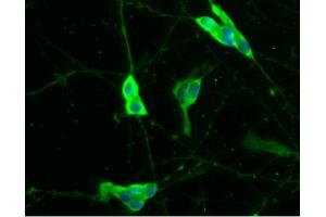 Immunofluorescent staining of differentiated SH-SY5Y cells (Human neuroblastoma, ATCC CRL-2266) (right). (S100B antibody  (AA 1-92))