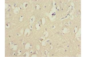 Immunohistochemistry of paraffin-embedded human brain tissue using ABIN7153074 at dilution of 1:100 (FOXN2 antibody  (AA 172-431))