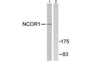 Western Blotting (WB) image for anti-Nuclear Receptor Co-Repressor 1 (NCOR1) (AA 51-100) antibody (ABIN2889273) (NCOR1 antibody  (AA 51-100))