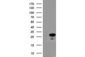 Western Blotting (WB) image for anti-Regulator of G-Protein Signaling 16 (RGS16) antibody (ABIN1500693) (RGS16 antibody)