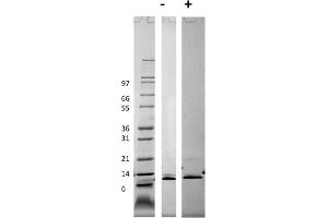 SDS-PAGE of Mouse Monocyte Chemotactic Protein-3 (CCL7) Recombinant Protein SDS-PAGE of Mouse Monocyte Chemotactic Protein-3 (CCL7) Recombinant Protein. (CCL7 Protein)