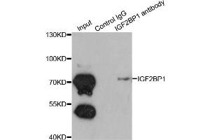 Immunoprecipitation analysis of 200ug extracts of K562 cells using 1ug IGF2BP1 antibody (ABIN6293020). (IGF2BP1 antibody)