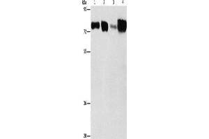 Western Blotting (WB) image for anti-Acyl-CoA Synthetase Long-Chain Family Member 4 (ACSL4) antibody (ABIN2429358) (ACSL4 antibody)