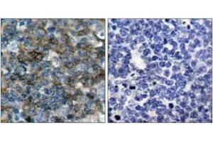 Immunohistochemistry (IHC) image for anti-Vasodilator-Stimulated phosphoprotein (VASP) (pSer157) antibody (ABIN2888553) (VASP antibody  (pSer157))