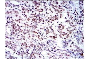 Immunohistochemistry (IHC) image for anti-BMI1 Polycomb Ring Finger Oncogene (BMI1) antibody (ABIN968985)