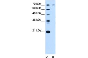 Western Blotting (WB) image for anti-Progesterone Receptor (PGR) antibody (ABIN2463798) (Progesterone Receptor antibody)