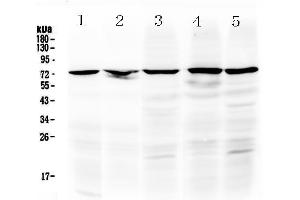 Western blot analysis of Raf1 using anti-Raf1 antibody . (RAF1 antibody  (AA 364-451))