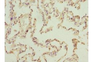 Immunohistochemistry of paraffin-embedded human lung tissue using ABIN7151524 at dilution of 1:100 (ELMOD1 antibody  (AA 185-334))
