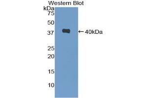 Detection of Recombinant GROb, Mouse using Polyclonal Antibody to Chemokine (C-X-C Motif) Ligand 2 (CXCL2) (CXCL2 antibody  (AA 28-100))