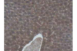 DAB staining on IHC-P; Samples: Mouse Liver Tissue (Interferon gamma antibody  (AA 23-155))