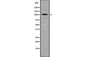 Western blot analysis of ROR2 using HeLa whole  lysates. (ROR2 antibody  (Internal Region))