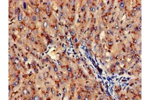 Immunohistochemistry of paraffin-embedded human liver tissue using ABIN7144005 at dilution of 1:100 (CD13 antibody  (AA 34-219))