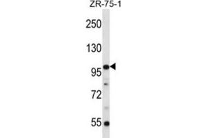 Western Blotting (WB) image for anti-Zinc Finger Protein 845 (ZNF845) antibody (ABIN2996686) (ZNF845 antibody)