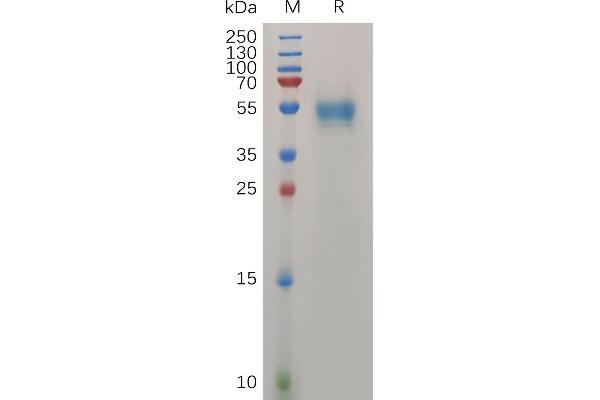 PRNP Protein (AA 90-230) (Fc Tag)