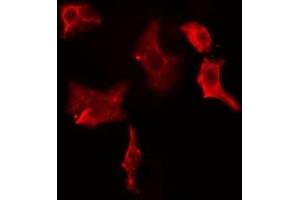 ABIN6274964 staining HeLa cells by IF/ICC. (CBR1 antibody  (C-Term))