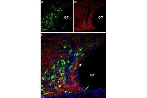 Multiplex staining of AT2 receptor and VGLUT2 in rat supraoptic hypothalamic nucleus - Immunohistochemical staining of perfusion-fixed frozen rat brain sections using Anti-Angiotensin II Receptor Type-2 (extracellular)-ATTO Fluor-488 Antibody (ABIN7042926), (1:60) and Anti-VGLUT2-ATTO Fluor-594 Antibody (ABIN7043682), (1:60). (Angiotensin II Type 2 Receptor antibody  (Extracellular, N-Term) (Atto 488))