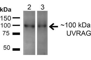 Western blot analysis of Human HeLa and 293T cell lysates showing detection of ~100kDa UVRAG protein using Rabbit Anti-UVRAG Polyclonal Antibody . (UVRAG antibody  (PerCP))