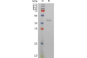 Human RETN Protein, hFc Tag on SDS-PAGE under reducing condition. (Resistin Protein (RETN) (AA 19-108) (Fc Tag))