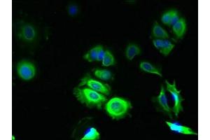 Immunofluorescent analysis of MCF-7 cells using ABIN7172949 at dilution of 1:100 and Alexa Fluor 488-congugated AffiniPure Goat Anti-Rabbit IgG(H+L) (TMCO5A antibody  (AA 10-192))