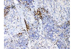 IHC analysis of IL17 using anti-IL17 antibody . (Interleukin 17a antibody  (AA 26-158))