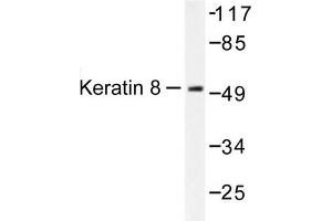 Image no. 1 for anti-Keratin 8 (KRT8) antibody (ABIN265504) (KRT8 antibody)