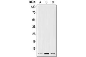 Western blot analysis of PS2 expression in MCF7 (A), mouse kidney (B), rat kidney (C) whole cell lysates. (TFF1 antibody  (Center))