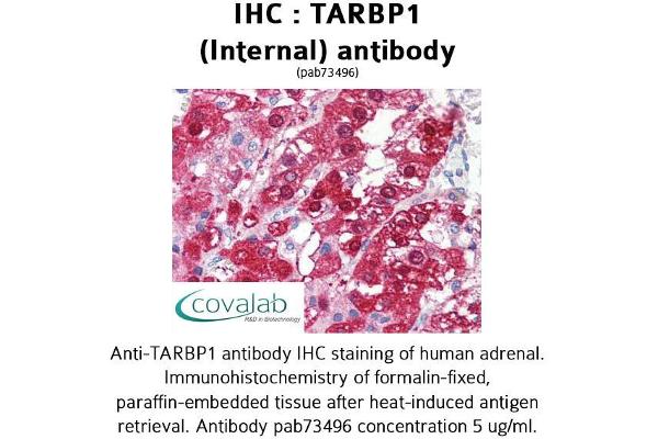 TARBP1 antibody  (Internal Region)
