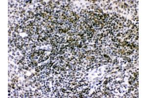 Anti- RAG2 Picoband antibody, IHC(P) IHC(P): Mouse Spleen Tissue (RAG2 antibody  (C-Term))