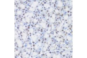 Immunohistochemistry of paraffin-embedded rat pancreas using MCM4 Antibody (ABIN3017195, ABIN3017196, ABIN1680801 and ABIN6219991) at dilution of 1:100 (40x lens). (MCM4 antibody)