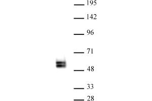 TCF7 antibody (pAb) tested by Western blot. (TCF7 antibody  (N-Term))