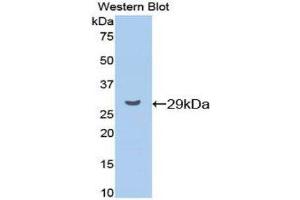 Western Blotting (WB) image for anti-Cyclin D1 (CCND1) (AA 31-295) antibody (ABIN1077956) (Cyclin D1 antibody  (AA 31-295))