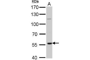 WB Image RAG2 antibody detects RAG2 protein by Western blot analysis. (RAG2 antibody  (Center))