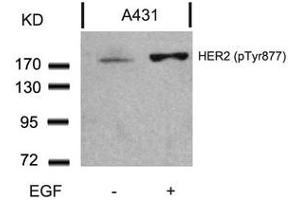 Western blot analysis of extracts from A431 cells untreated or treated with EGF using HER2(Phospho-Tyr877) Antibody. (ErbB2/Her2 antibody  (pTyr877))