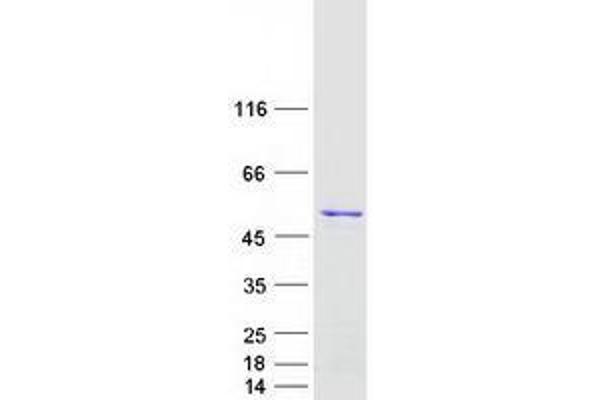 Trnt1 Protein (Transcript Variant 1) (Myc-DYKDDDDK Tag)