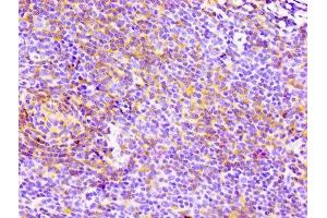 IHC image of ABIN7127280 diluted at 1:100 and staining in paraffin-embedded human lymph node tissue performed on a Leica BondTM system. (Recombinant CD4 antibody)