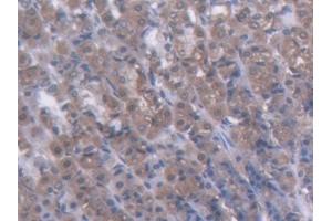 IHC-P analysis of Rat Stomach Tissue, with DAB staining. (GCK antibody  (AA 194-410))