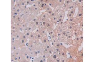 Used in DAB staining on fromalin fixed paraffin- embedded liver tissue (TREX1 antibody  (AA 6-369))