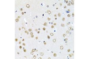 Immunohistochemistry of paraffin-embedded rat brain using RAB3IP antibody. (RAB3IP antibody  (AA 1-150))